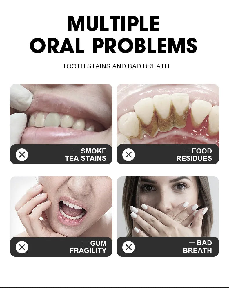 SP-10 Probiotic Toothpaste